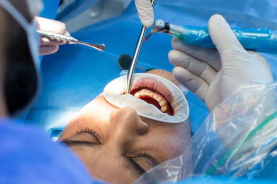 Advanced Oral & Maxillofacial Surgery