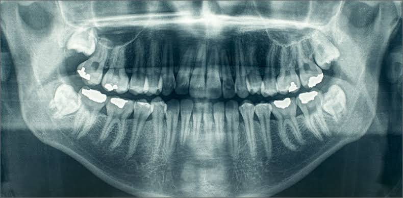 Dental X-Ray & Diagnostics